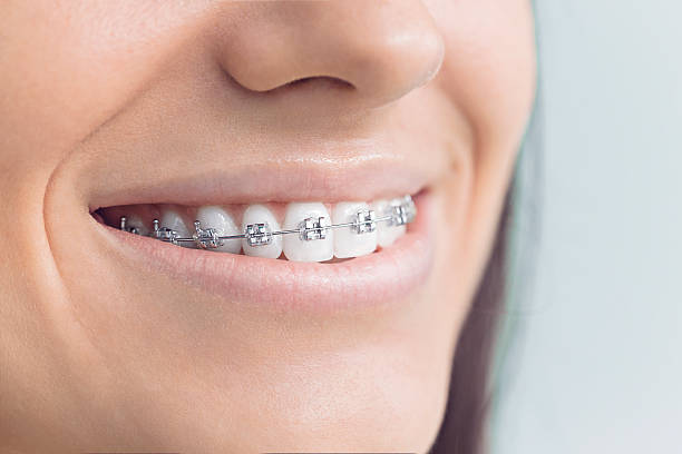 Best Cosmetic Dentistry  in Windsor, MO